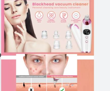 Best Facial Mart dropshipping products: Blackhead Remover Tools